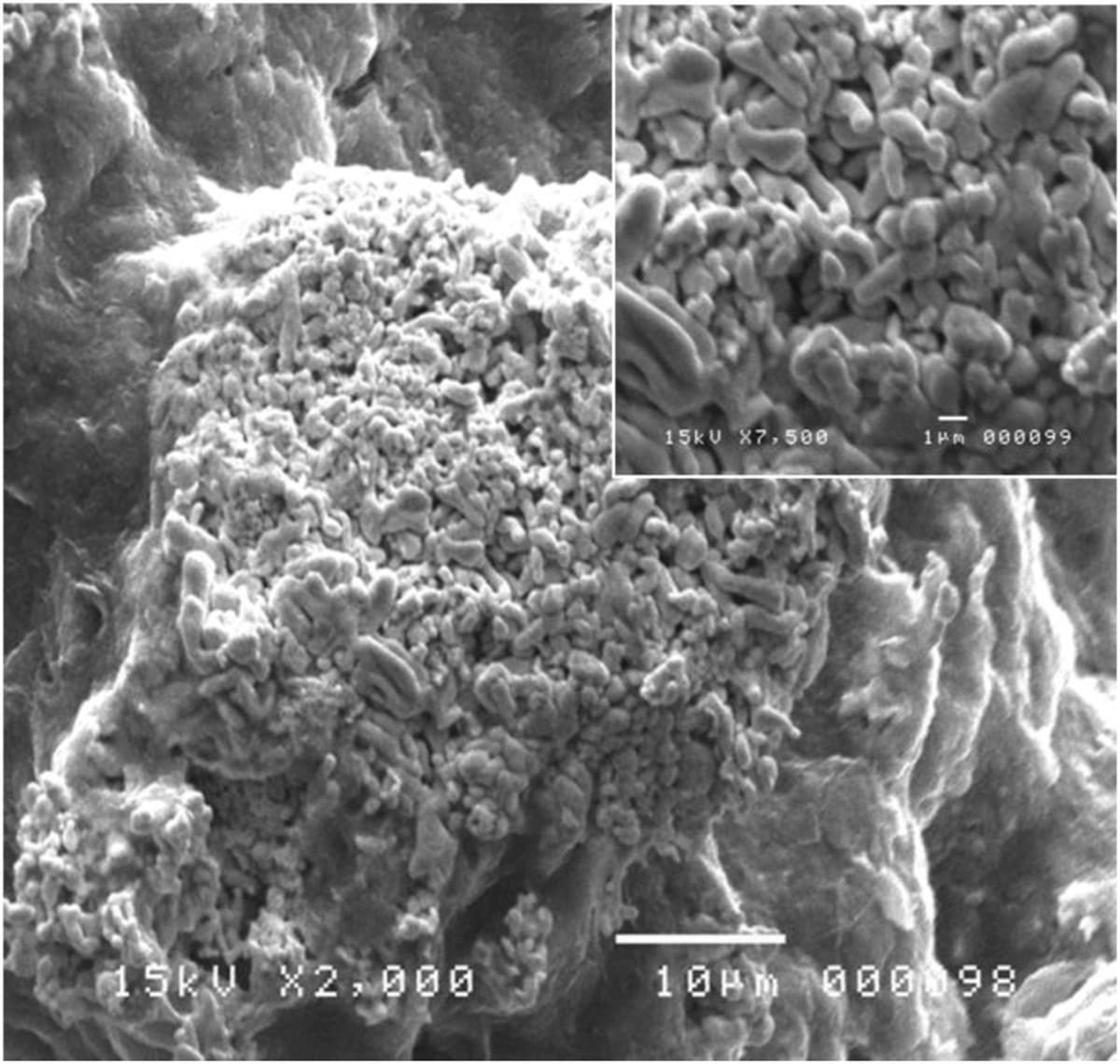 Scanning electron micrograph of dendritic silver microclusters covering a silicon grain.